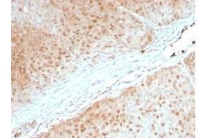 Formalin-fixed, paraffin-embedded human Pancreas stained with AKT1 Mouse Monoclonal Antibody (AKT1/2552). (AKT1 anticorps  (AA 85-189))