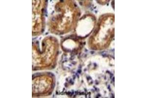 WT1 Antibody (Center E361) immunohistochemistry analysis in formalin fixed and paraffin embedded human kidney tissue followed by peroxidase conjugation of the secondary antibody and DAB staining. (WT1 anticorps  (Middle Region))