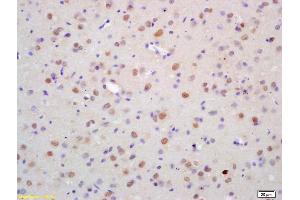 Formalin-fixed and paraffin embedded rat brain labeled with Anti-ZNF312 Polyclonal Antibody, Unconjugated (ABIN1386712) at 1:200 followed by conjugation to the secondary antibody and DAB staining (FEZF2 anticorps  (AA 10-120))