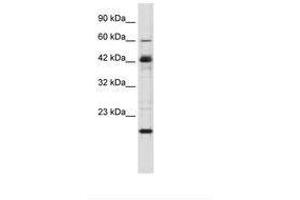 Image no. 2 for anti-Zinc Finger Protein 24 (ZNF24) (AA 189-238) antibody (ABIN6735862) (ZNF24 anticorps  (AA 189-238))