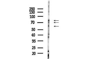 anti-Dopachrome Tautomerase (DCT) (N-Term) antibody