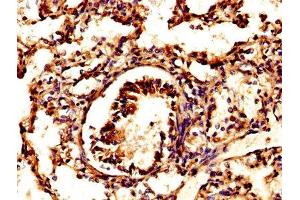 IHC image of ABIN7164840 diluted at 1:500 and staining in paraffin-embedded human lung tissue performed on a Leica BondTM system. (Prosaposin anticorps  (AA 311-391))