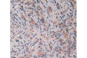 Used in DAB staining on fromalin fixed paraffin- embedded prostate gland cancer tissue (CD109 anticorps  (AA 1146-1390))