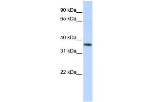 WB Suggested Anti-OR13C5 Antibody Titration: 0.