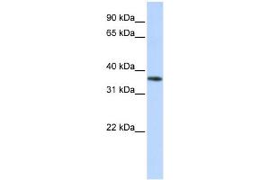 WB Suggested Anti-OR13C5 Antibody Titration: 0. (OR13C5 anticorps  (Middle Region))