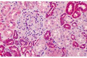 Human Kidney: Formalin-Fixed, Paraffin-Embedded (FFPE)