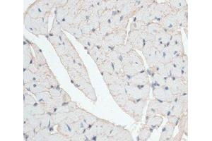 Immunohistochemistry of paraffin-embedded Mouse heart using DMD Polyclonal Antibody at dilution of 1:100 (40x lens).