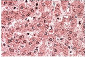AP22390PU-N ALDH5A1 antibody staining of paraffin embedded Human Liver at 5 µg/ml. (ALDH5A1 anticorps  (Internal Region))