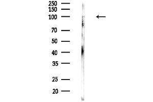 anti-Chondroitin Sulfate Synthase 1 (CHSY1) (Internal Region) antibody