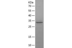 Western Blotting (WB) image for B-Cell CLL/lymphoma 9 (BCL9) (AA 1-239) protein (His tag) (ABIN7121965)