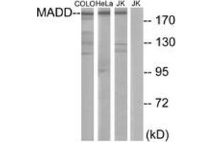 Western blot analysis of extracts from COLO/HeLa/Jurkat cells, using MADD Antibody. (MADD anticorps  (AA 751-800))