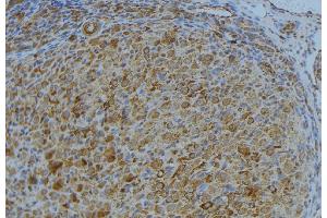 ABIN6276697 at 1/100 staining Human uterus tissue by IHC-P. (TIMP3 anticorps  (Internal Region))