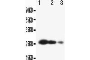 Anti-TIMP3 antibody, Western blotting Lane 1: Recombinant Human TIMP3 Protein 10ng Lane 2: Recombinant Human TIMP3 Protein 5ng Lane 3: Recombinant Human TIMP3 Protein 2.