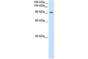 WB Suggested Anti-DDX54 Antibody Titration:  0. (DDX54 anticorps  (C-Term))