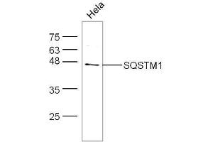 SQSTM1 anticorps  (AA 51-150)