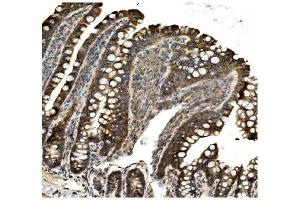 IHC analysis of Aconitase 1/ACO1 using anti-Aconitase 1/ACO1 antibody (ABIN7598988). (Aconitase 1 anticorps  (AA 1-137))