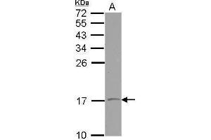 WB Image Sample (30 ug of whole cell lysate) A: NT2D1 15% SDS PAGE antibody diluted at 1:500 (VAMP1 anticorps)
