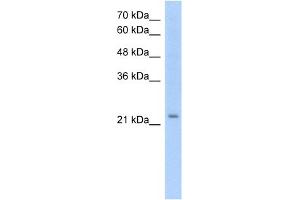 WB Suggested Anti-EMP2 Antibody Titration:  1. (EMP2 anticorps  (Middle Region))