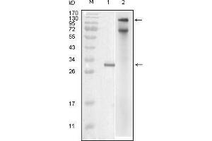Western blot analysis using IKBKE mouse mAb against truncated IKBKE recombinant protein (1) and full-length IKBKE(aa1-716)-hIgGFc transfected COS7 cell lysate (2). (IKKi/IKKe anticorps  (AA 1-257))