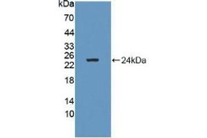 Detection of Recombinant GM2A, Human using Polyclonal Antibody to GM2 Ganglioside Activator (GM2A) (GM2A anticorps  (AA 24-193))