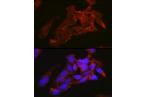 Immunofluorescence analysis of U2OS cells using NRAS Rabbit pAb (ABIN7267532) at dilution of 1:100 (40x lens).