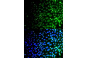 Immunofluorescence analysis of  cells using ULK4 antibody (ABIN6132771, ABIN6149925, ABIN6149926 and ABIN6223359).