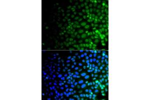Immunofluorescence analysis of  cells using ULK4 antibody (ABIN6132771, ABIN6149925, ABIN6149926 and ABIN6223359). (ULK4 anticorps  (AA 1-290))