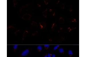 Immunofluorescence analysis of U-2 OS cells using ETHE1 Polyclonal Antibody at dilution of 1:100 (40x lens). (ETHE1 anticorps)