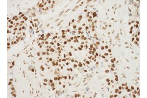Immunohistochemistry (IHC) image for anti-Nucleophosmin (Nucleolar phosphoprotein B23, Numatrin) (NPM1) (AA 250-294) antibody (ABIN7448992) (NPM1 anticorps  (AA 250-294))