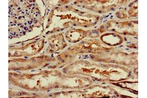 Immunohistochemistry of paraffin-embedded human kidney tissue using ABIN7175703 at dilution of 1:100 (WSB1 anticorps  (AA 201-421))
