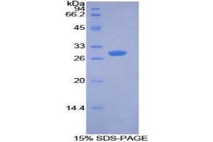 SDS-PAGE (SDS) image for Pyruvate Dehydrogenase Kinase 1 (PDK1) (AA 172-399) protein (His tag) (ABIN2126587)