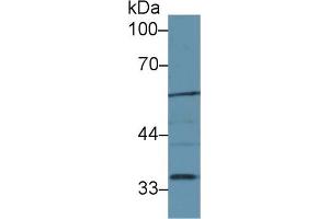 Western Blot; Sample: Mouse Liver lysate; Primary Ab: 1µg/ml Rabbit Anti-Mouse LIPG Antibody Second Ab: 0. (LIPG anticorps  (AA 115-369))