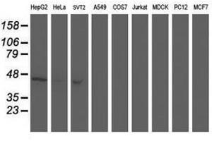 Image no. 5 for anti-Aminoacylase 1 (ACY1) antibody (ABIN1496454) (Aminoacylase 1 anticorps)