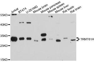 Western blot analysis of extracts of various cell lines, using TRMT61A antibody. (TRMT61A anticorps)