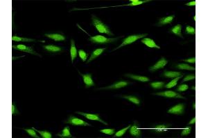 Immunofluorescence of purified MaxPab antibody to DGKZ on HeLa cell. (DGKZ anticorps  (AA 1-929))