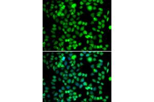 Immunofluorescence analysis of U20S cell using FKBP6 antibody. (FKBP6 anticorps)