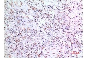 Immunohistochemistry (IHC) analysis of paraffin-embedded Human Brain, antibody was diluted at 1:100.