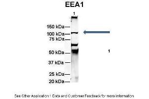 Amount and Sample Type :  500 ug rat brain homogenate  Amount of IP Antibody :  6 ug  Primary Antibody :  EEA1  Primary Antibody Dilution :  1:500  Secondary Antibody :  Goat anti-rabbit Alexa-Fluor 594  Secondary Antibody Dilution :  1:5000  Gene Name :  EEA1  Submitted by :  Dr. (EEA1 anticorps  (N-Term))