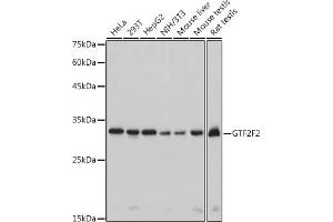Western blot analysis of extracts of various cell lines, using GTF2F2 antibody (ABIN7267373) at 1:1000 dilution. (GTF2F2 anticorps)