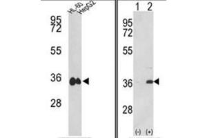 (LEFT) Western blot analysis of MDH1 Antibody (C-term) in HL-60, HepG2 cell line lysates (35ug/lane). (MDH1 anticorps  (C-Term))