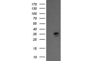 Image no. 3 for anti-Kinesin Family Member 25 (KIF25) antibody (ABIN1499039)