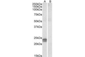 Western Blotting (WB) image for anti-High Mobility Group AT-Hook 1 (HMGA1) (Internal Region) antibody (ABIN2464248) (HMGA1 anticorps  (Internal Region))