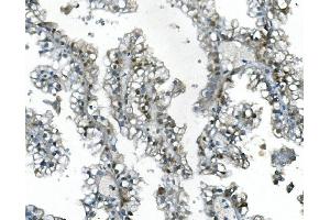 IHC analysis of UBR2 using anti-UBR2 antibody (ABIN7599609). (UBR2 anticorps  (AA 10-664))