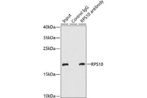 Immunoprecipitation analysis of 200 μg extracts of MCF-7 cells using 1 μg RPS10 antibody (ABIN6132944, ABIN6147191, ABIN6147193 and ABIN6221584). (RPS10 anticorps  (AA 1-165))