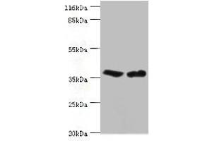 Western blot All lanes: CA5B antibody at 2 μg/mL Lane 1: Mouse liver tissue Lane 2: Mouse kidney tissue Secondary Goat polyclonal to rabbit IgG at 1/10000 dilution Predicted band size: 36 kDa Observed band size: 36 kDa (CA5B anticorps  (AA 34-314))