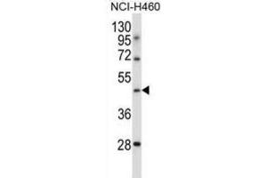 Western Blotting (WB) image for anti-Transducin-Like Enhancer of Split 6 (TLE6) antibody (ABIN2997351) (TLE6 anticorps)