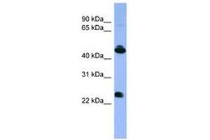 Image no. 1 for anti-Opsin 1 (Cone Pigments), Medium-Wave-Sensitive (OPN1MW) (C-Term) antibody (ABIN6746666)