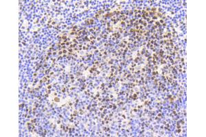 Paraformaldehyde-fixed, paraffin embedded human tonsil section, Antigen retrieval by boiling in sodium citrate buffer (pH6) for 15min, Block endogenous peroxidase by 3% hydrogen peroxide for 30 minutes, Blocking buffer (normal serum) at 37°C for 20min, Antibody incubation with Nrf2(S40) (7G4) Monoclonal Antibody  at 1:50 overnight at 4°C, followed by a conjugated secondary and DAB staining.
