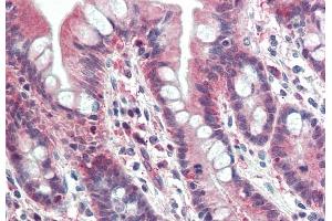 ABIN571002 (5 μg/mL) staining of paraffin embedded Human Small Intestine. (PSMB10 anticorps  (Internal Region))