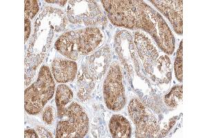 ABIN6266700 at 1/100 staining human kidney tissue sections by IHC-P.